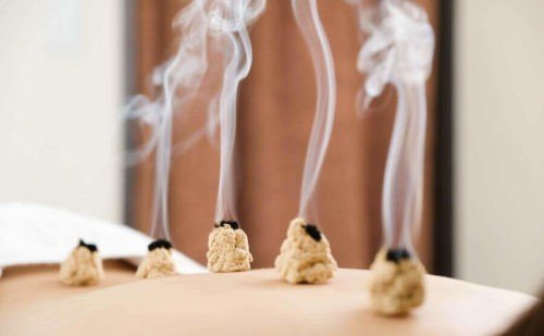 Chinetsukyu de moxa encendido durante una sesión de moxibustión japonesa