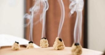 Conos de moxibustión japonesa Chinetsukyu utilizados en un tratamiento de Medicina Tradicional China
