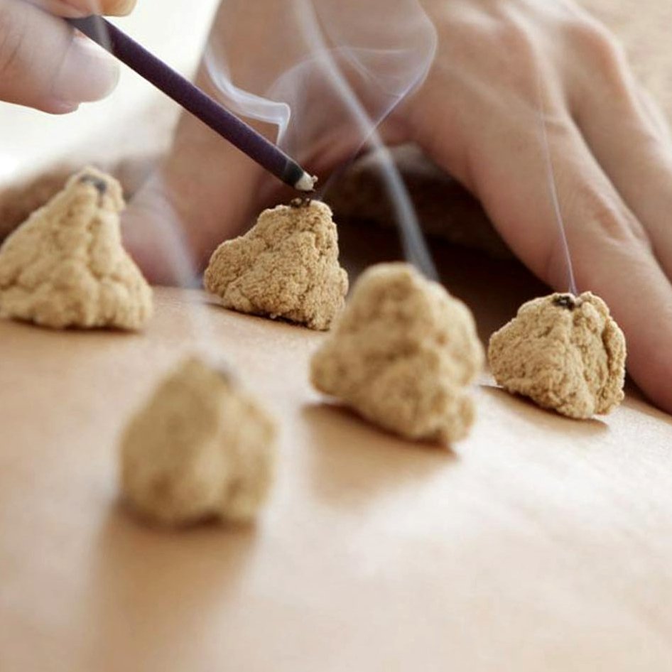 Varios conos Chinesky preparados y mano de terapeuta encendiéndolos con incienso